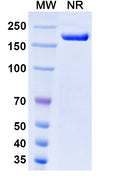 Anti-Human PSMA/FOLH1/NAALADase I Reference Antibody (Rosopatamab) – Figure 1 of 2