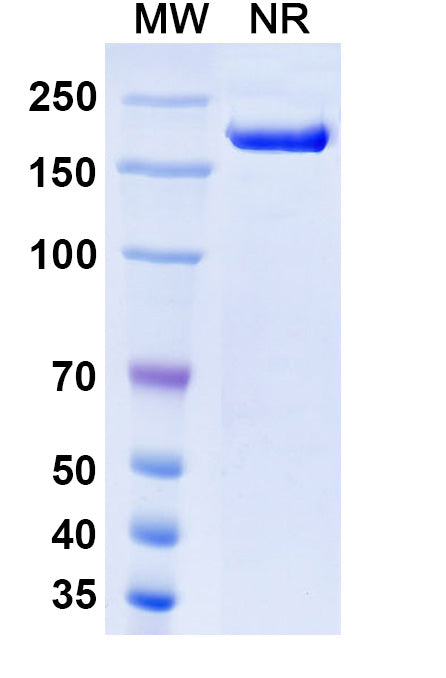 Anti-Human PSMA/FOLH1/NAALADase I Reference Antibody (Rosopatamab) – Figure 1 of 2