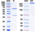 Anti-Human FOLH1/PSMA Reference Antibody (MLN2704) – Figure 1 of 1