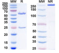 Anti-Human FOLH1/PSMA Reference Antibody (MT112) – Figure 1 of 1