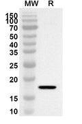 Western blot analysis was performed using anti-Human HTR4 polyclonal antibody at 1ug/mL on recombinant Human HTR4 (Catalog No. HC684012).
