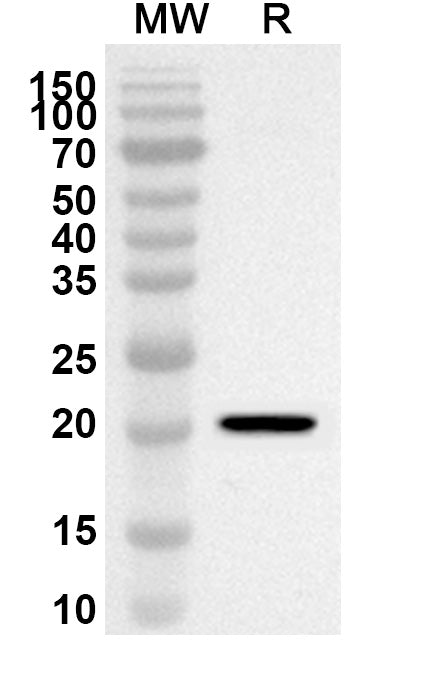 Western blot analysis was performed using anti-HLTF polyclonal antibody at 1ug/mL on recombinant HLTF (Catalog No. HC685012).