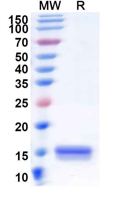 Recombinant Human CD218a/IL18R1 Protein, N-His