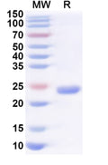 Recombinant Human DLG1 Protein, N-His