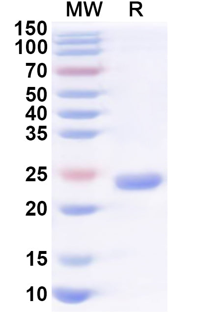 Recombinant Human DLG1 Protein, N-His