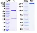 SDS-PAGE for Anti-Human FGL2 Antibody (SAA1675)