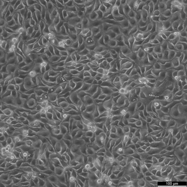 HCC1806 cell