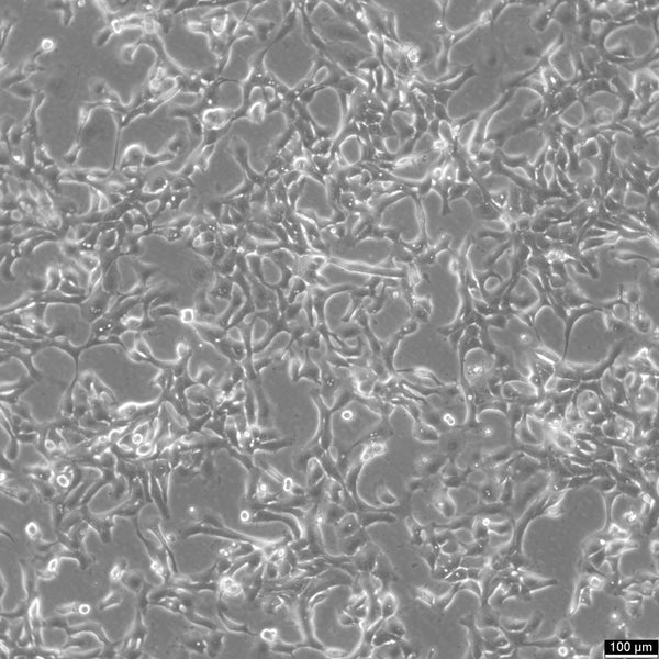 HCC70 cell