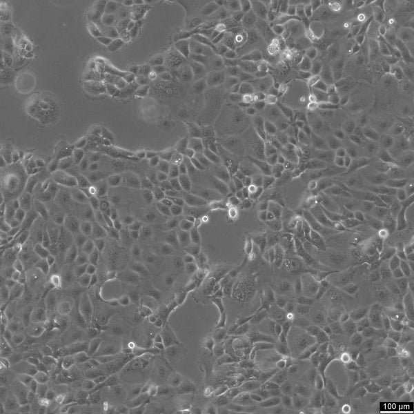 HCC78 cell