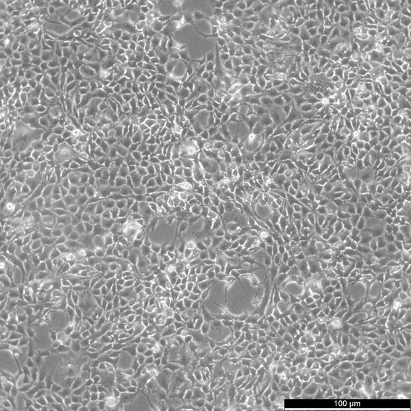 HCC827 cell