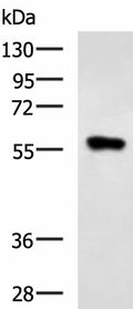 SQSTM1 Polyclonal Antibody – Figure 1 of 3