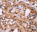 HIST1H1C Polyclonal Antibody – Figure 1 of 2