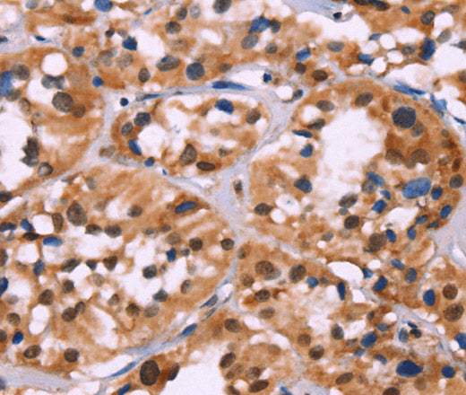 HIST1H1C Polyclonal Antibody – Figure 1 of 2