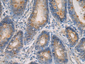 MAPKAPK3 Polyclonal Antibody – Figure 1 of 3