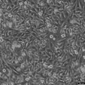 HEp-2 cell