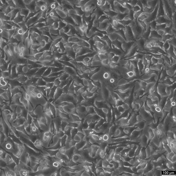 HEp-2 cell