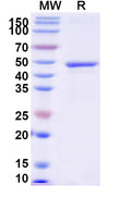 Recombinant Human EGFR/ERBB1/HER1 Protein, N-His
