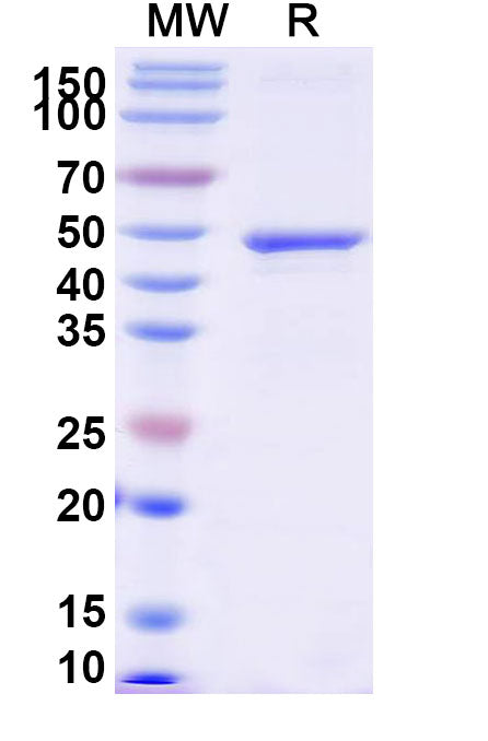 Recombinant Human EGFR/ERBB1/HER1 Protein, N-His