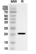 Western blot analysis was performed using anti-EGFR/ERBB1/HER1 polyclonal antibody at 1ug/mL on recombinant EGFR/ERBB1/HER1 (Catalog No. HF004052).