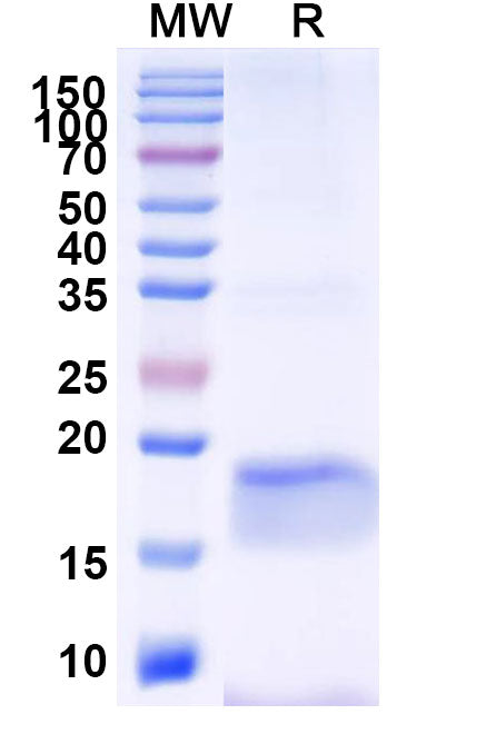 SDS-PAGE for Anti-Human EGFR/ERBB1/HER1 Nanobody (9G8)