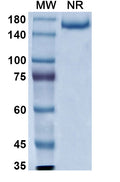 Anti-Human EGFR Reference Antibody (Zalutumumab) – Figure 1 of 3