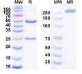 SDS-PAGE for Anti-Human EGFR/ERBB1/HER1 Antibody (11F8)