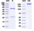 Anti-Human EGFR/ERBB1/HER1 Reference Antibody (SCT200) – Figure 1 of 1