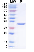 Recombinant Human PLG/Plasminogen Protein, N-His
