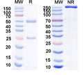 SDS-PAGE for Anti-Aldh1L1 Antibody (N103/1)