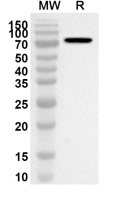 Western blot analysis was performed using anti-EFEMP2 polyclonal antibody at 1ug/mL on recombinant EFEMP2 (Catalog No. HF514012).