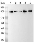 Western blot analysis was performed using anti-PRDM1  polyclonal antibody at 1ug/mL on various samples.
Lane 1: Hela cell lysate
Lane 2: A549 cell lysate
Lane 3: A431 cell lysate
Lane 4: NIH3T3 cell lysate
Lane 5: Raji cell lysate