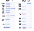 SDS-PAGE for Anti-Glycine receptor Alpha3 Antibody (N424/62)