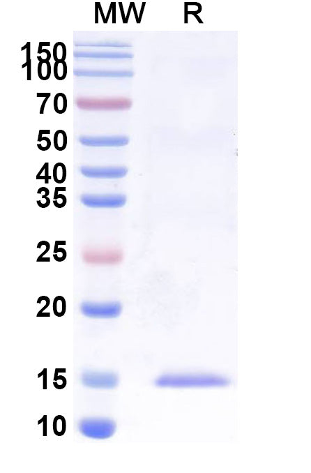 SDS-PAGE for Anti-Human PLAU Nanobody (SAA1008)