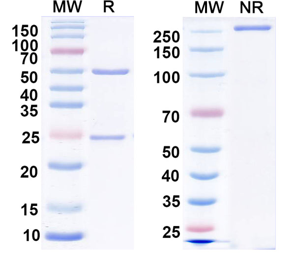 SDS-PAGE for Anti-DEPDC5 Antibody (N463/45)