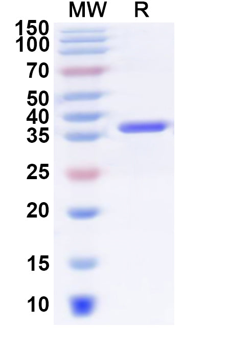 Recombinant Human SDC3 Protein, N-His-KSI