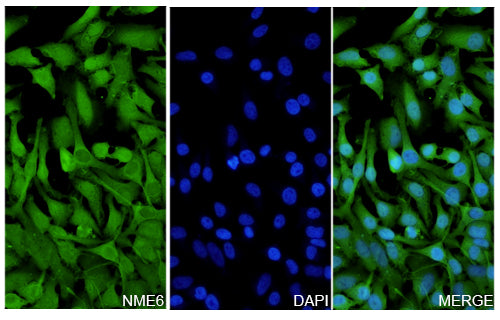 Hela cells were fixed with 4% paraformaldehyde for 20 minutes, followed by blocking with 5% goat serum for 1 hour. The cells were then incubated with a primary antibody targeting NME6 (HF556014) at a concentration of 26.6 ug/ml overnight at 4°C. Afterward, the cells were incubated with a secondary antibody, Goat Anti-Rabbit IgG (Alexa Fluor-488) for 50 minutes at room temperature. The localization of NME6 was visualized (shown in green), and nuclear DNA was stained with DAPI (shown in blue).
