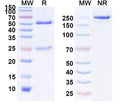 Anti-Human IL-38/IL-1F10 Reference Antibody (Faralimomab) – Figure 1 of 1
