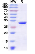 Recombinant Human ABL1 Protein, N-His