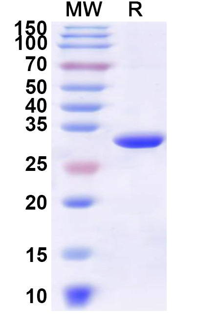 Recombinant Human ABL1 Protein, N-His