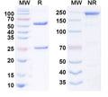 Anti-Human LGR5/GPR49 Reference Antibody (18G7H6A3) – Figure 1 of 1