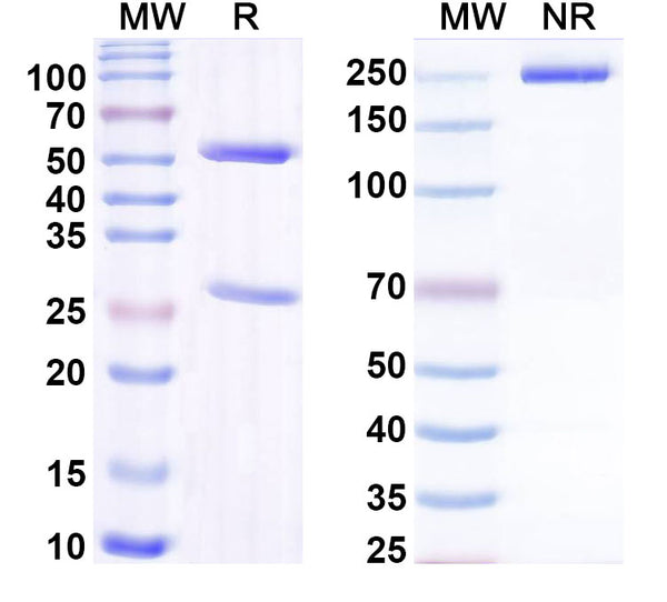 SDS-PAGE for Anti-Human RAMP3 Antibody (SAA1504).