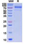 Recombinant Human PIVKA-II/DCP Protein, C-His