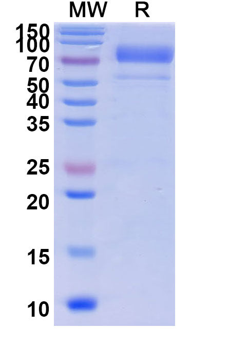 Recombinant Human PIVKA-II/DCP Protein, C-His