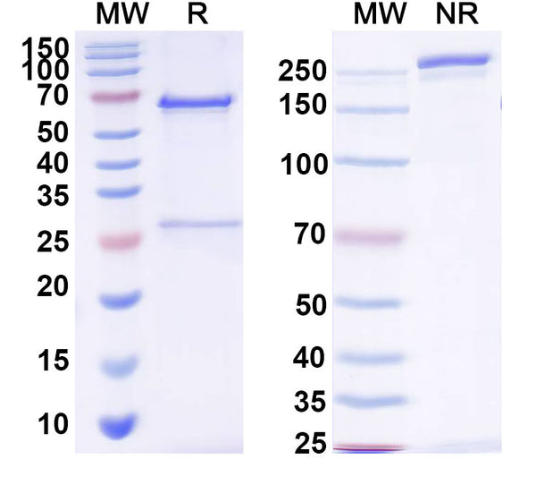 SDS-PAGE for Anti-Human PIVKA-II/DCP Monoclonal Antibody (1A301)