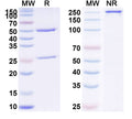 SDS-PAGE for Anti-Human PIVKA-II/DCP Monoclonal Antibody (1A302)