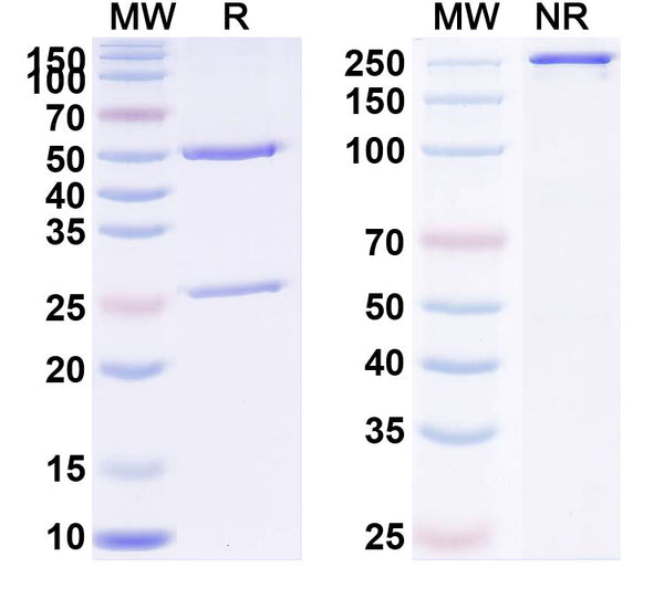 SDS-PAGE for Anti-Human PIVKA-II/DCP Monoclonal Antibody (1A302)