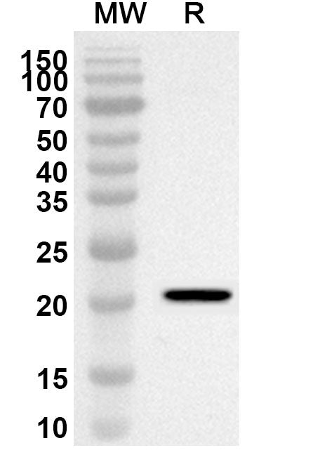 Western blot analysis was performed using anti-Human DIRAS1 polyclonal antibody at 1ug/mL on recombinant Human DIRAS1 (Catalog No. HF625012).