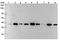 Western blot analysis was performed using anti-MACROH1A2 polyclonal antibody at 1μg/ml on various samples.
Lane 1: MCF7 cell lysate
Lane 2: Hela cell lysate
Lane 3: Rat brain lysate
Lane 4: Rat liver lysate
Lane 5: 293T cell lysate
Lane 6: HepG2 cell lysate
Lane 7: Mouse brain lysate
Lane 8: Mouse liver lysate
Lane 9: Rat lung lysate