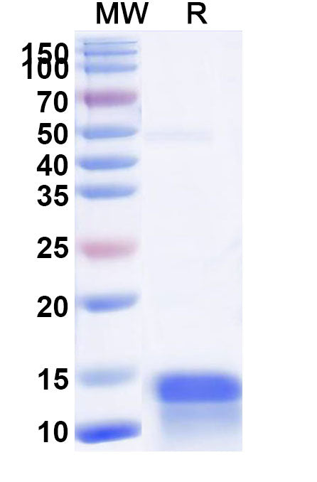 SDS-PAGE for Anti-Human CALCA/Calcitonin Nanobody (SAA1243)
