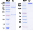 SDS-PAGE for Anti-Human Alpha-1-antitrypsin/SERPINA1 antibody (SAA2228)